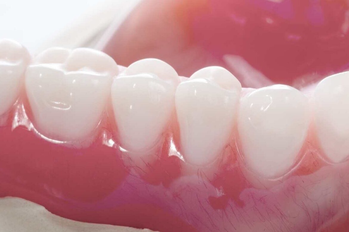 Denture Treatment SG